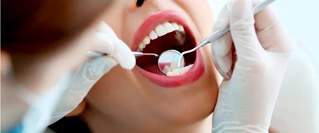 tandhygienist.webp