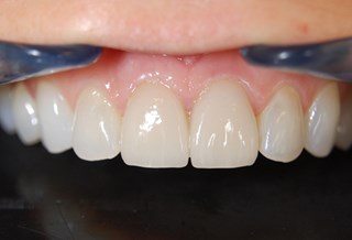 emax-img.jpg