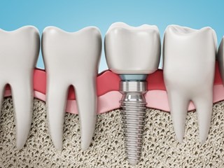 AdobeStock_474157717.jpg