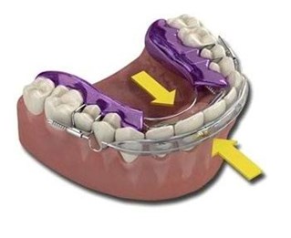 top_bottom_aligner_arrows2.jpg